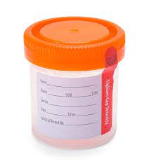 How is urinalysis cup?