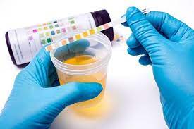 Is urine test result oriented?
