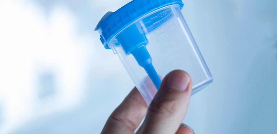 Why Do You Need A Personal Cup For Urinalysis