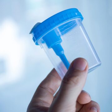 Why Do You Need A Personal Cup For Urinalysis